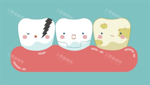 牙齿美白对比卡通图 牙齿美白对比卡通图
