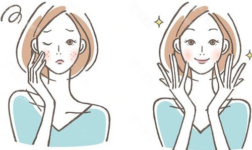 激光祛斑后的成效 激光祛斑后的成效