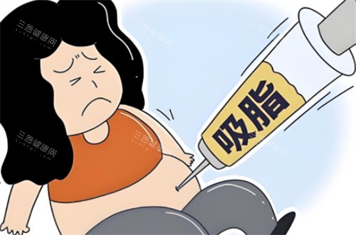 南宁吸脂手术哪家医院好？这份名单中的医院能避免过度抽脂，线条自然更耐看，重点是无隐形消费