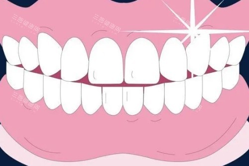 整齐牙齿卡通图