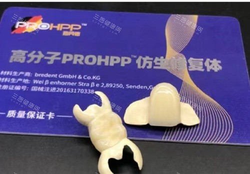 hpp粘接桥牙齿单颗示意图