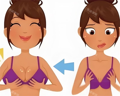 隆胸手术前后对比动画图 隆胸手术前后对比动画图