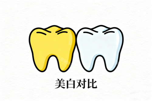 牙齿美白前后对比展示图