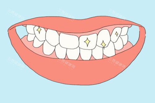 牙齿美白改善图展示 牙齿美白改善图展示