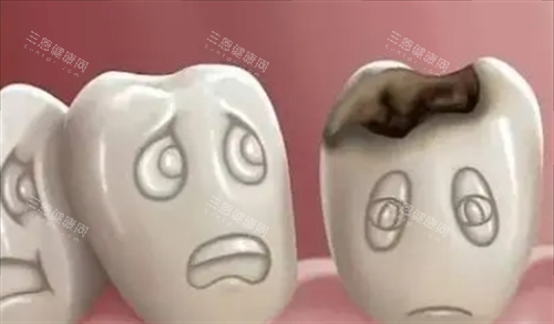 烂牙齿动画展示