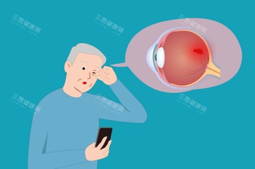 老年人白内障卡通图 老年人白内障卡通图