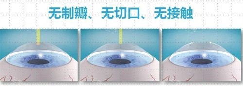 常州爱尔眼科超正规！连锁品牌维持+诊疗透明，设备较高医师正规，看眼放心