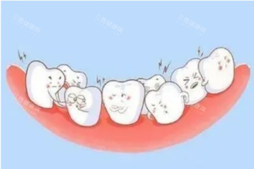 牙齿畸形卡通图