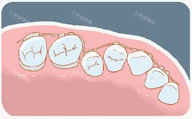 牙齿矫正漫画牙齿图