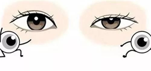 先天小睑裂综合征和正常眼睛的对比