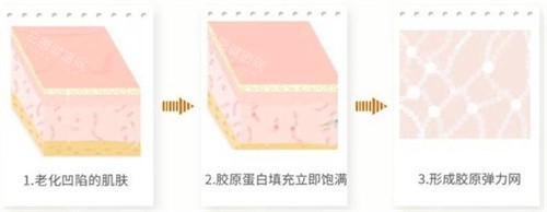  私密注射胶原蛋白1年真实记录：我的维持时间凭什么比别人多3个月？经验大公开！