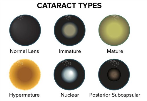 不同眼睛问题 不同眼睛问题