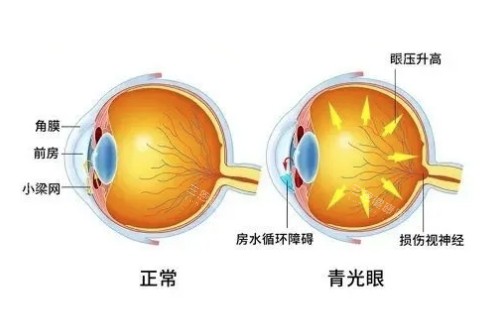 河北省眼科医院预约挂号攻略：含现场挂号方式，诊前必看注意事项