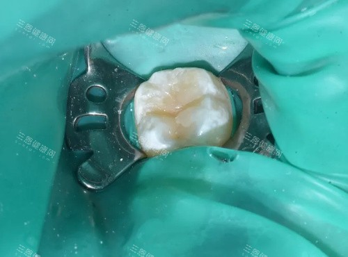 成都补牙怎么选？推荐来啦！10家网友强烈推荐的口碑榜牙科，附地址+价格，看牙不迷路！