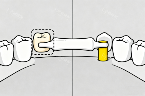 镶牙卡通展示图