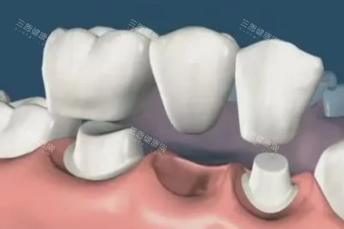 镶牙卡通图片一览