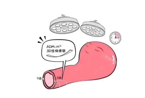 怎么预约紧缩针注射？医院能打紧缩针吗？预约方式及流程一览!