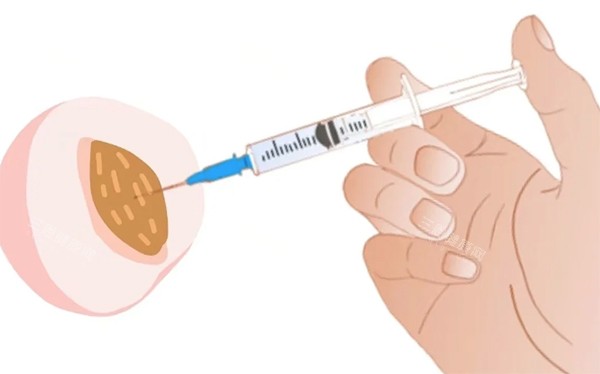 私密注射紧缩针照片 私密注射紧缩针照片