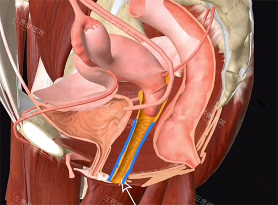 阴道紧缩针动画原理 阴道紧缩针动画原理