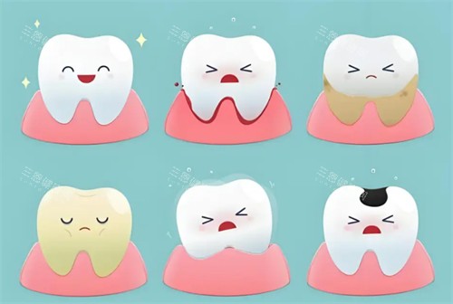 健康牙齿与不健康牙齿的状态