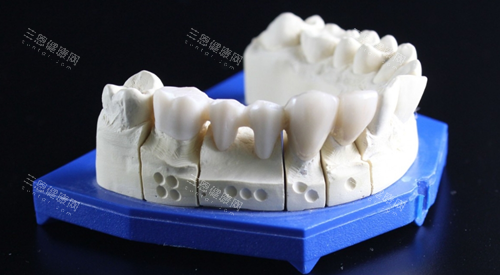 牙齿模型图