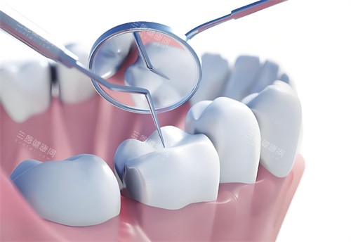 牙齿检查卡通图展示