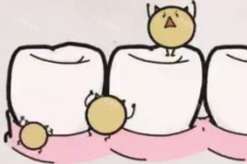 牙齿有细菌卡通图