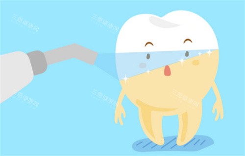 牙齿美白前后对比 牙齿美白前后对比