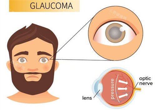 网选国内青光眼医生排名榜揭晓!这些技术好口碑佳的医生值得关注
