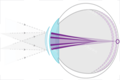 美视季离焦镜片和新乐学离焦镜片哪个好?深度对比两大品牌技术特点与适用人群