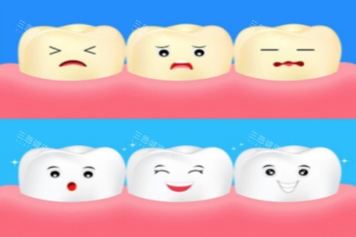 牙齿美白卡通展示 牙齿美白卡通展示