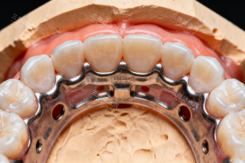 牙齿矫正之后的样子一览