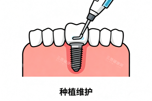 种植牙维护卡通图