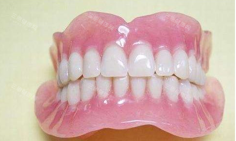 吸附性义齿照片