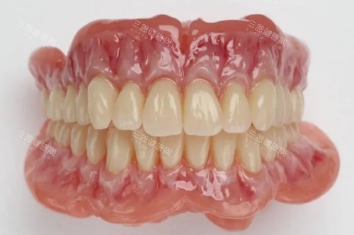 吸附性义齿模型图片展示