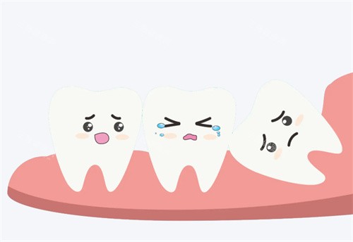 亲身经历揭秘：成都圣贝口腔拔智齿怎么样？技术、服务全体验！