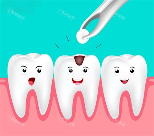 补牙示意图