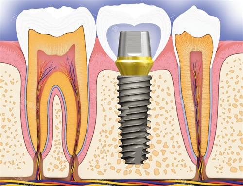 2025常德石门康贝口腔价格表查询，种牙/矫正牙齿/根管治疗及补牙费用