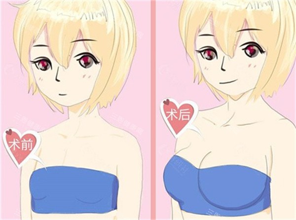 幸蕴丰胸是正规品牌吗？幸蕴无痕丰胸真实结果、可靠性和术后反馈大揭秘~