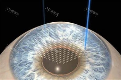 郴州市第三人民医院眼科价格表查看，青光眼3000起/白内障5000起/近视手术8000起！