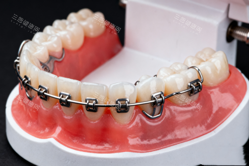 高新区牙齿矫正哪里好？探秘茁悦口腔舌侧隐形矫正技术真实结果