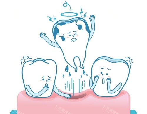牙齿脱落漫画示意图