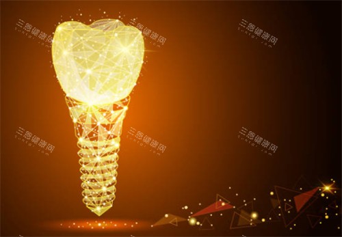 种植牙科技感背景图 种植牙科技感背景图