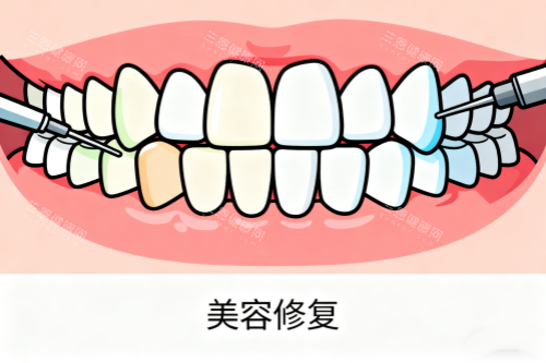 牙齿美容修复卡通图