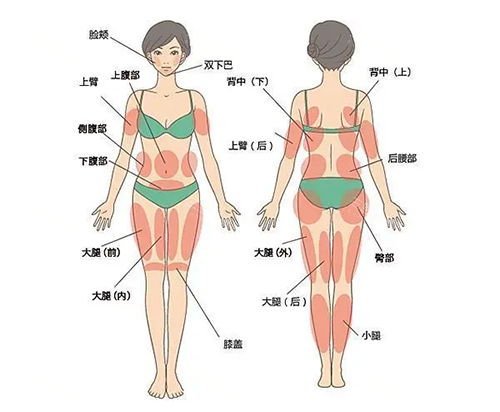 吸脂身体部位图片 吸脂身体部位图片