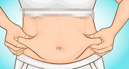 吸脂手术腹部脂肪堆积 吸脂手术腹部脂肪堆积