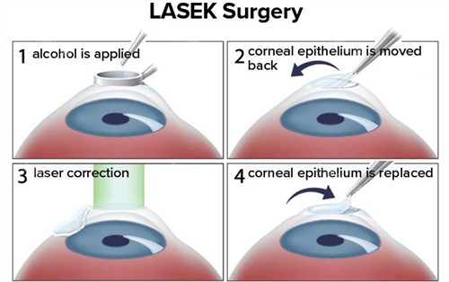 辽宁省金秋医院眼科价格表2026公开！近视手术10800+、白内障4000+、青光眼800+