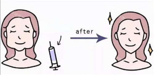 打针瘦脸卡通图