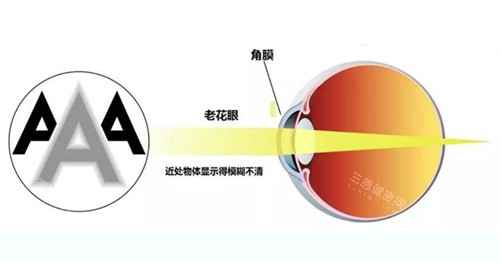 老花眼的眼睛 老花眼的眼睛