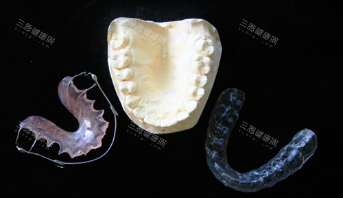 牙齿矫正模型图 牙齿矫正模型图